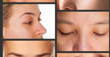What Are the Causes of Twisting of the Left Eyelid